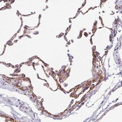 Immunohistochemistry-Paraffin: LIMCH1 Antibody [NBP2-39006]