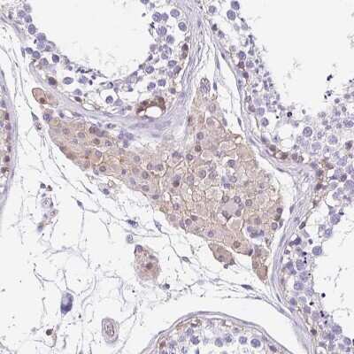 Immunohistochemistry-Paraffin: LIMCH1 Antibody [NBP2-39006]