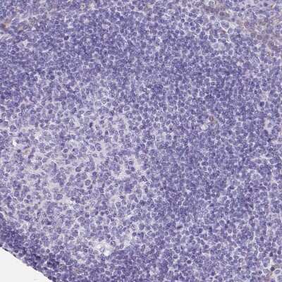 Immunohistochemistry-Paraffin: LIMCH1 Antibody [NBP2-39006]