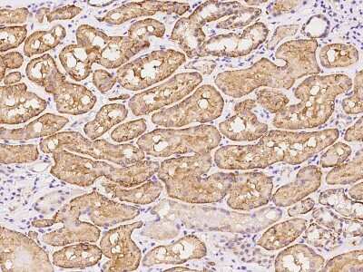 Immunohistochemistry-Paraffin: LIMCH1 Antibody [NBP2-97832]
