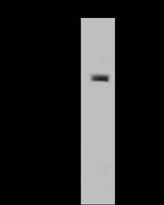 Western Blot: LIMCH1 Antibody [NBP2-97832]