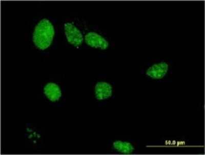 Immunocytochemistry/ Immunofluorescence: LIMD1 Antibody (2G5) [H00008994-M01]