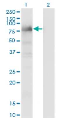 Western Blot: LIMD1 Antibody (2G5) [H00008994-M01]