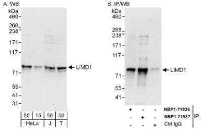 Western Blot: LIMD1 Antibody [NBP1-71937]