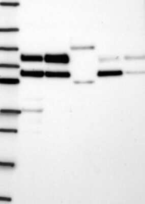 Western Blot: LIMD1 Antibody [NBP3-17878]