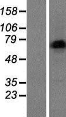 Western Blot: LIMD1 Overexpression Lysate [NBP2-07368]