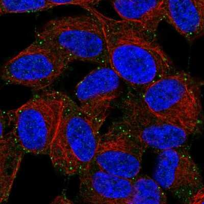 Immunocytochemistry/ Immunofluorescence: LIMD2 Antibody [NBP2-56208]