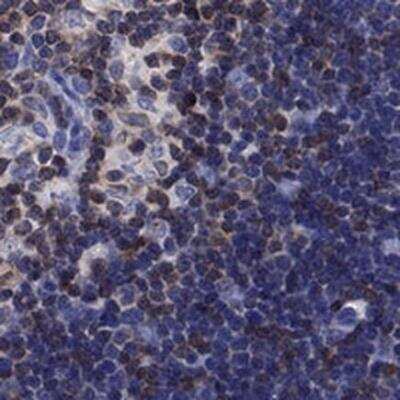 Immunohistochemistry-Paraffin: LIMD2 Antibody [NBP3-17511]