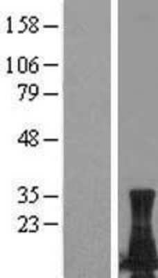 Western Blot: LIMD2 Overexpression Lysate [NBL1-12534]