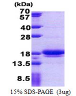 SDS-PAGE: Recombinant Human LIMD2 His Protein [NBP2-23193]