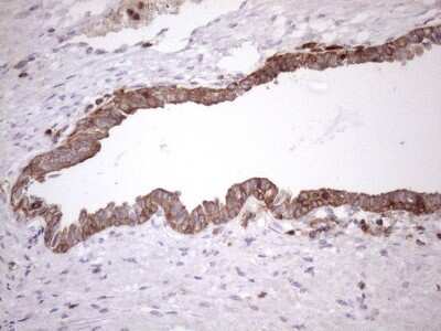 Immunohistochemistry: LIME Antibody (OTI5D3) [NBP2-45653]