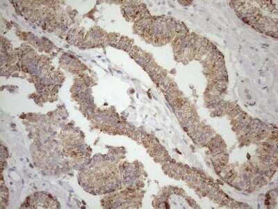 Immunohistochemistry: LIME Antibody (OTI5D3) [NBP2-45653]