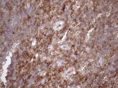 Immunohistochemistry: LIME Antibody (OTI5D3) [NBP2-45653]