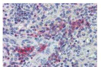 Immunohistochemistry: LIME Antibody [NBP1-44946]