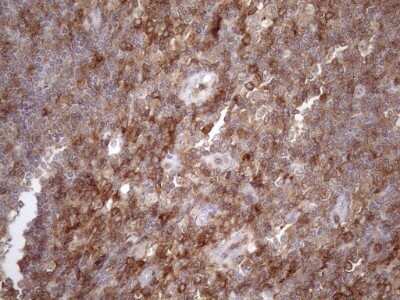 Immunohistochemistry: LIME Antibody (OTI5D3) - Azide and BSA Free [NBP2-71974]