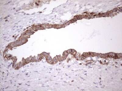Immunohistochemistry: LIME Antibody (OTI5D3) - Azide and BSA Free [NBP2-71974]