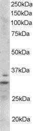 Western Blot: LIME Antibody [NB100-1436]