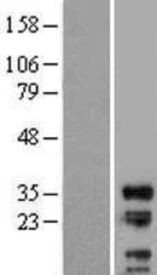 Western Blot: LIME Overexpression Lysate [NBL1-12535]