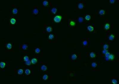 Immunocytochemistry/ Immunofluorescence: LIMPII/SR-B2 Antibody (052) [NBP2-90382]