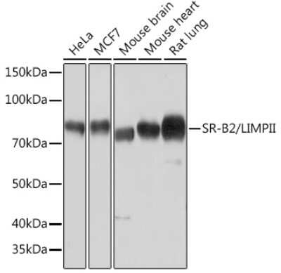 Western Blot: LIMPII/SR-B2 Antibody (7D2P5) [NBP3-16779]