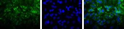 Immunocytochemistry/ Immunofluorescence: LIMPII/SR-B2 Antibody [NB400-129]