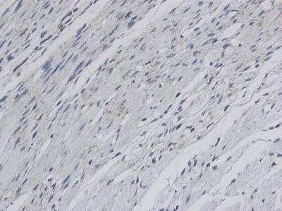 Immunohistochemistry: LIMPII/SR-B2 Antibody [NB400-129]