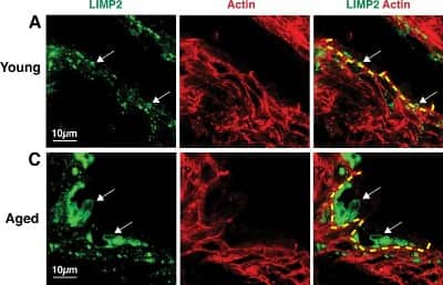 Immunohistochemistry-Paraffin: LIMPII/SR-B2 Antibody [NB400-129]