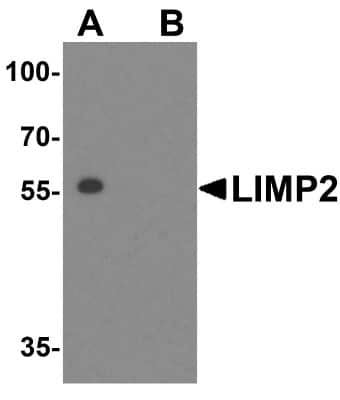 Western Blot: LIMPII/SR-B2 AntibodyBSA Free [NBP1-77326]