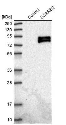 Western Blot: LIMPII/SR-B2 Antibody [NBP1-84583]