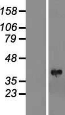 Western Blot: PINCH1/LIMS1 Overexpression Lysate [NBL1-12539]