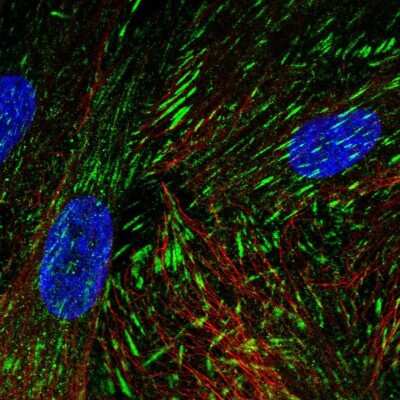 Immunocytochemistry/ Immunofluorescence: LIMS2 Antibody [NBP2-31713]