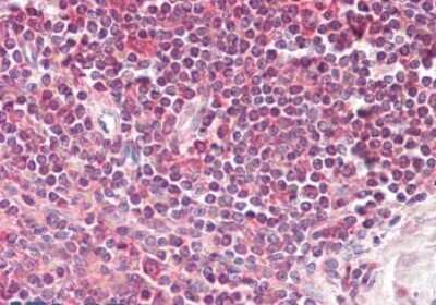 Immunohistochemistry-Paraffin: LIMS2 Antibody [NBP1-52185]