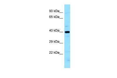 Western Blot: LIMS2 Antibody [NBP2-85209]