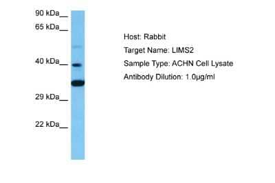 Western Blot: LIMS2 Antibody [NBP2-85210]