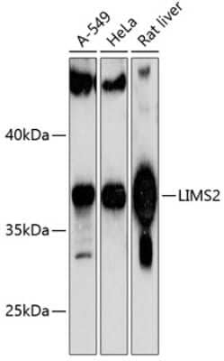 Western Blot: LIMS2 AntibodyAzide and BSA Free [NBP3-04692]