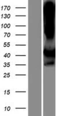 Western Blot: LIMS2 Overexpression Lysate [NBP2-06891]