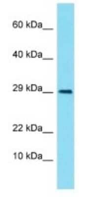 Western Blot: LIMS3 Antibody [NBP3-09748]