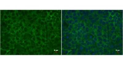 Immunocytochemistry/ Immunofluorescence: LIN-28A Antibody (1086) [NBP2-43673]