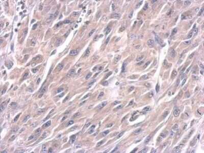 Immunohistochemistry-Paraffin: LIN-28A Antibody (1086) [NBP2-43673]
