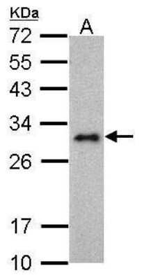 Western Blot: LIN-28A Antibody (1086) [NBP2-43673]