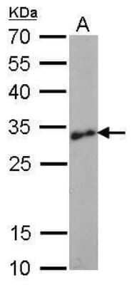 Western Blot: LIN-28A Antibody (1086) [NBP2-43673]