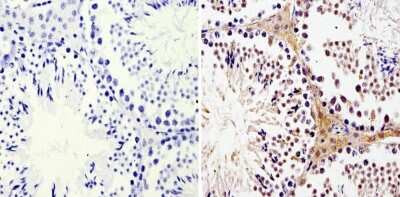 Immunohistochemistry-Paraffin: LIN-28A Antibody (14E6-4E6) [NBP2-22481]
