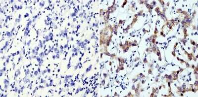 Immunohistochemistry-Paraffin: LIN-28A Antibody (14E6-4E6) [NBP2-22481]