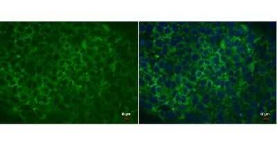 Immunocytochemistry/ Immunofluorescence: LIN-28A Antibody (717) [NBP2-43672]