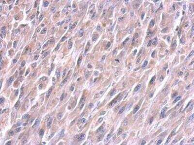 Immunohistochemistry: LIN-28A Antibody (717) [NBP2-43672]