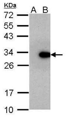 Western Blot: LIN-28A Antibody (717) [NBP2-43672]