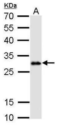 Western Blot: LIN-28A Antibody (717) [NBP2-43672]