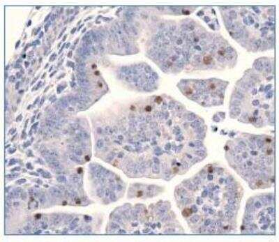 Immunohistochemistry: LIN-28A Antibody [NBP1-49537]