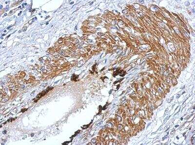Immunohistochemistry-Paraffin: LIN-28A Antibody [NBP2-19355]