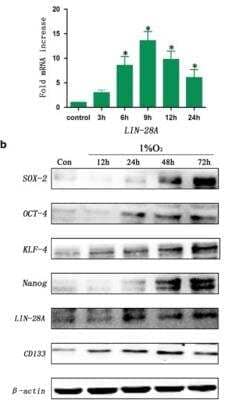 Western Blot: LIN-28A Antibody [NBP1-49537]